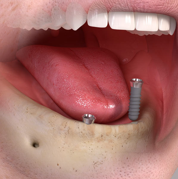 teeth