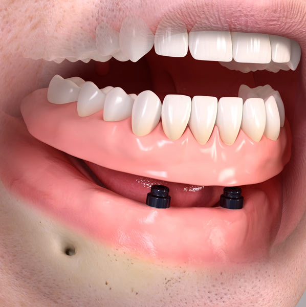 teeth