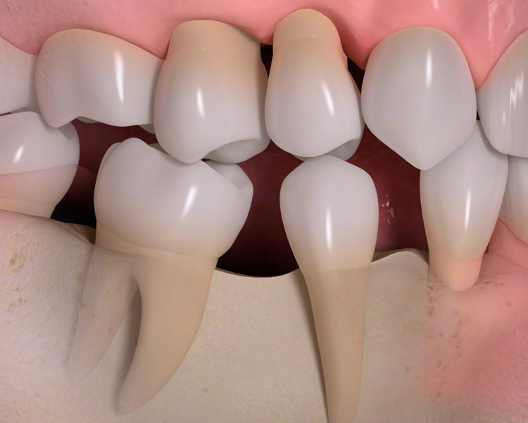 teeth