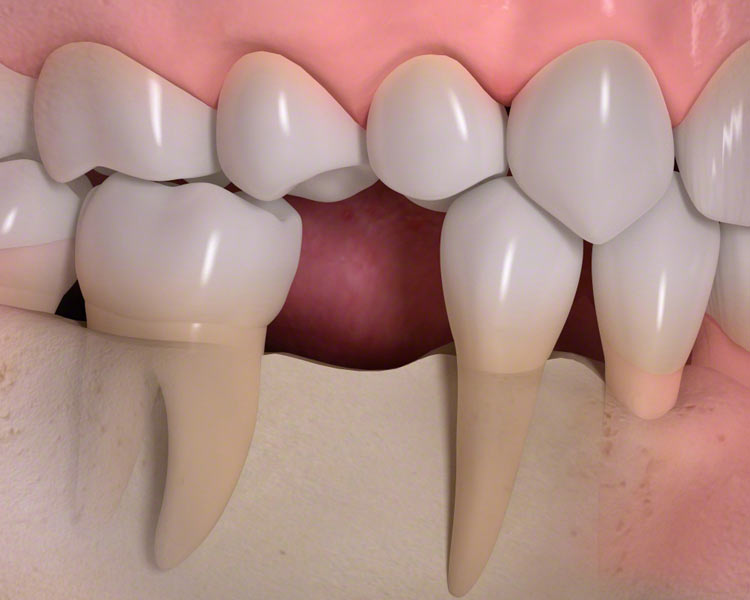 teeth